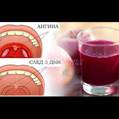 Лилавата сила срещу болкото гърло: Как цвеклото става истински спасител