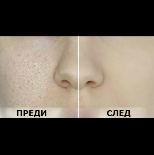 Кожа като кадифе: Как да заличим разширените пори с продукти от кухнята