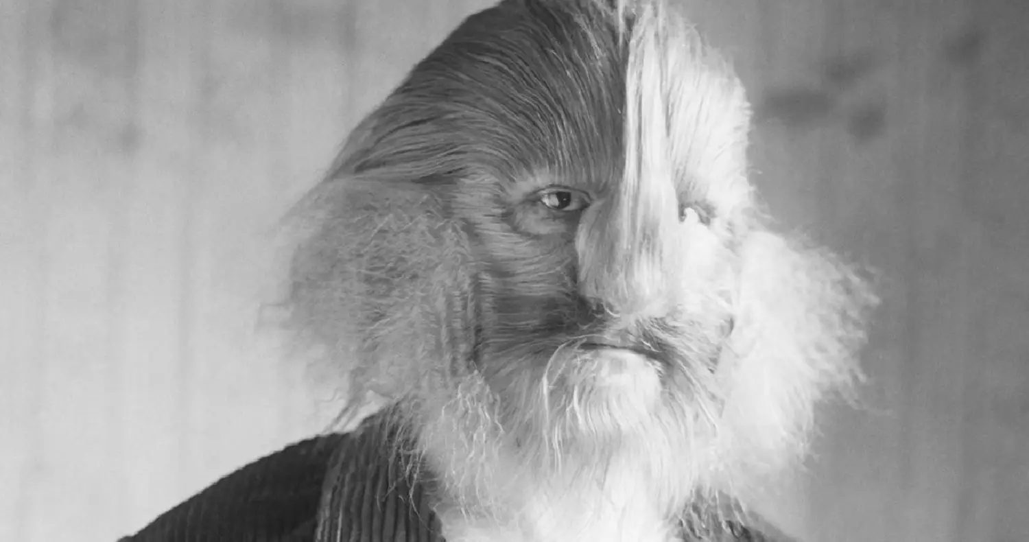 Човекът-Лъв, Който Надхитри Съдбата: Невероятната История на Стефан Бибровски