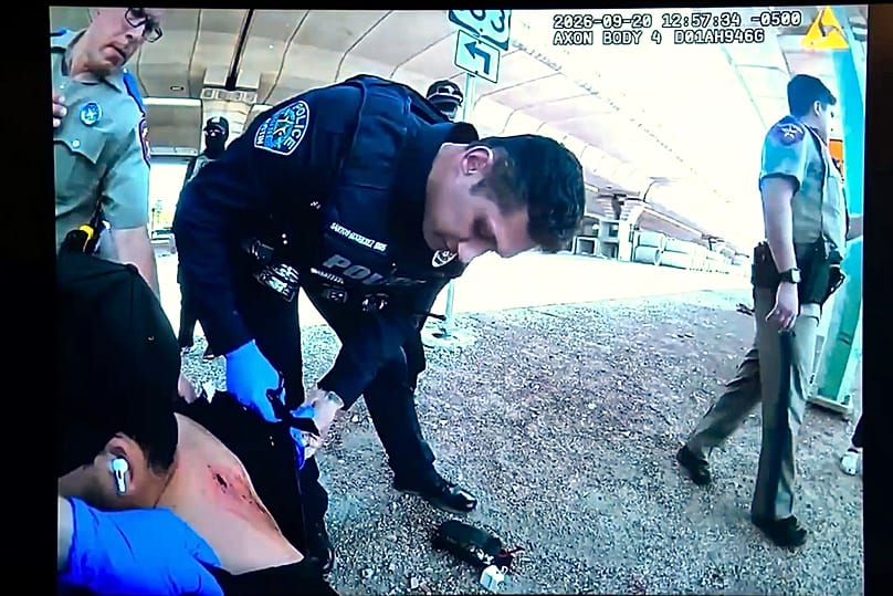 Inspection of a wound after shooting